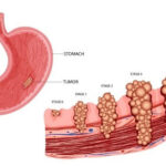 Best Gastroenterologist in Secunderabad - Dr. K V Dinesh Reddy