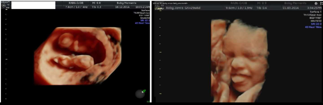 Baby Moments Cover Image