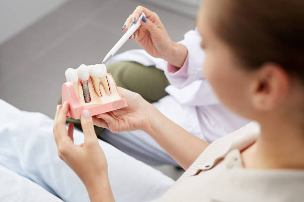 Dental Implant Guide: Everything You Need to Know Before Treatment – Telegraph
