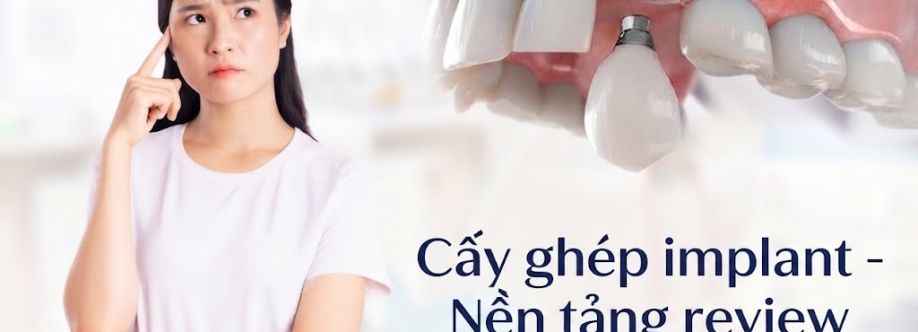 Cấy Ghép Implant Cover Image